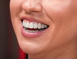 image.png.9ae9ae70d433dece2e9878dc959a3460.png